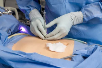 бариатрическая хирургия